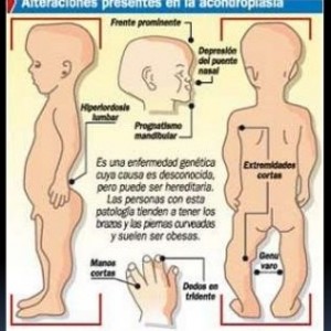 genetica-acondroplasia-18-638